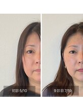 アウル 鳳店(OWL)/