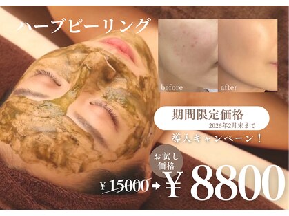 アンズ(ANZU.)の写真