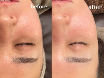 エンソワー(en'sower)/シェービングで透明感UP♪