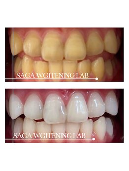 佐賀ホワイトニングラボ/