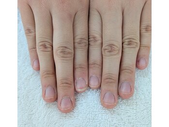 ネイルサロンひまわり/【自爪ケア・1】施術前の状態