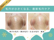 ココミエレ(COCO MIELE)の雰囲気（今の肌に必要なケアを見極めることを大切にしています。）