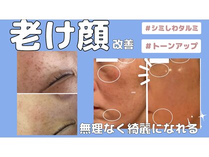 ミライ(Mirai)の写真