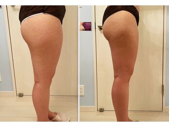 メゾン アンジュ(Maison Ange)/脚2回目/レモンボトル