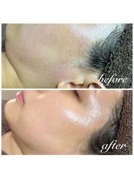 セリジェ 青山(Cerisier)/お顔剃りはお肌に良い事ばかり☆