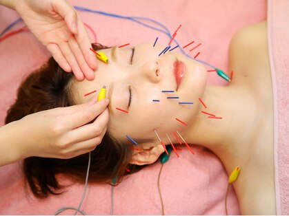 ルナ(Luna)の写真