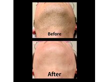 フィズ 溝の口店(FIS)の雰囲気（毎日の自己処理が楽になり、肌荒れ防止にも効果的！【脱毛】）