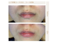 エスト(Est_.)の雰囲気(美容電気脱毛:他店の残り毛もスッキリ!)