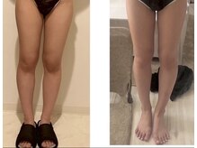 ヨサパーク アクアマリン 日野店(YOSA PARK)/美脚効果も◎