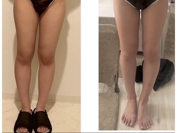 ヨサパーク アクアマリン 日野店(YOSA PARK)/美脚効果も◎