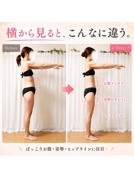 ヨサパーク ラプラス(YOSA PARK Laplace)の写真/理想の美脚へ！むくみにさようなら！脂肪燃焼と代謝アップを実感☆