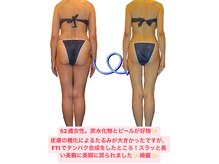 エステティック アントワネットの雰囲気（52歳女性/ナノカレントエステ全身）