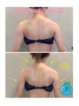 エクセレントビューティーサロン 艶(EN)/ブライダル１回