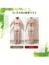 楽の匠/ヒップアップもできます♪