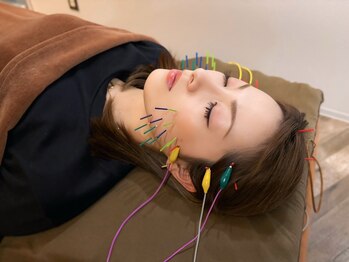 アラキ(ARAKI)/緑橋美容鍼【電気美容鍼】