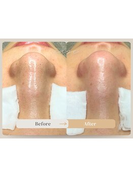 お肌をきれいにしたい