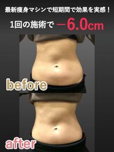 蓮子の夢/お腹周り比較