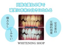 ホワイトニングショップ 日進店