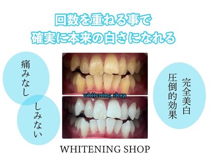 ホワイトニングショップ 日進店の写真