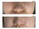 ピンナ(PINNA)の写真
