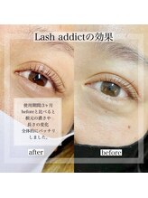 まつげエクステ専門店 アイラ 船橋店(EYELA)/ラッシュアディクト取扱店