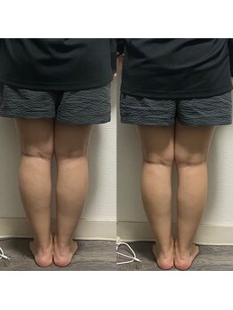 月ト華/整体・痩身・レモンボトル