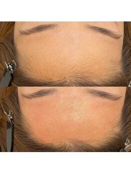 アトリエ ハルミナ(atelier harumina)/韓国美肌Wax★