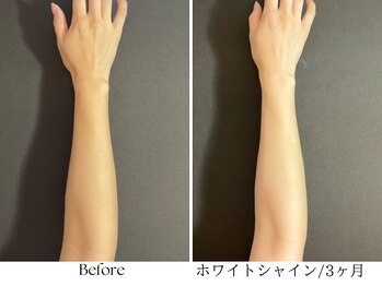 ビボーラ(BEBEAURA)/ホワイトシャイン