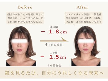 アロハ(ALOHA.)/鏡を見るたびに嬉しくなる未来へ