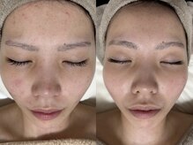 肌だけじゃない。頭痛・便通などなど体調まで良くなる方も続出。