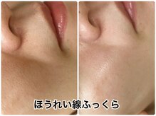 エクラの雰囲気（繰り返す肌トラブルに終わりを！キャンペーン中【詳細はブロブ】）