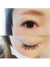 フランセス(Frances)/セクシーデザイン