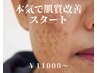 【肌改善スタートメニュー】本気でお肌を改善したいあなた　11，000円