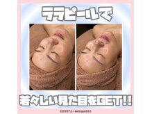 ホワイトアクア 岐阜店(WHITE AQUA)/ララピール/ハーブピーリング