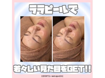 ホワイトアクア 岐阜店(WHITE AQUA)/ララピール/ハーブピーリング