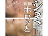 【満足度No.1★】9600円お得！シミケア20分+ライトフェイシャル¥23500→13900
