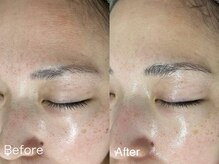 サロンドジェシカ(salon de Jessica)/プラズマ  