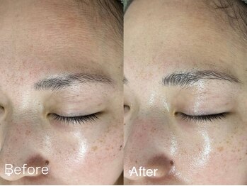 サロンドジェシカ(salon de Jessica)/プラズマ  