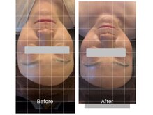 ナツミ(723)/脂肪分解レモンボトル！