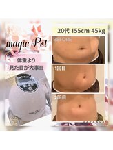 エステサロン ジュレ(JuRER)/ガッツリ！痩身！ポット