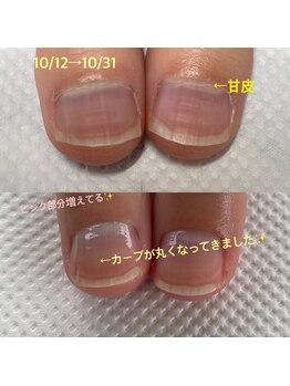 張りついた甘皮がスッキリ！！