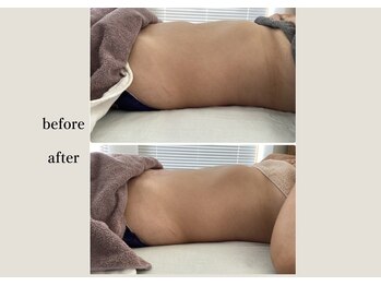 アンドスロウ(&slow)/ゆるかっさ