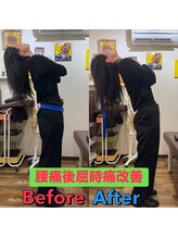 ヒデ整体院(Hide整体院)/猫背矯正骨盤矯正B/A肩こり腰痛