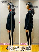 ヒーレンス(HEALENCE)/ストレートネック＋巻き肩