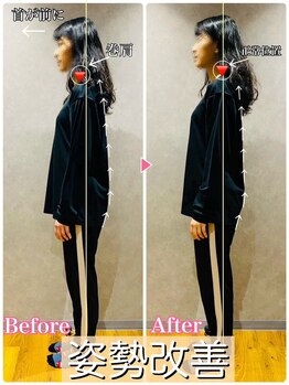 ヒーレンス(HEALENCE)/ストレートネック+巻き肩