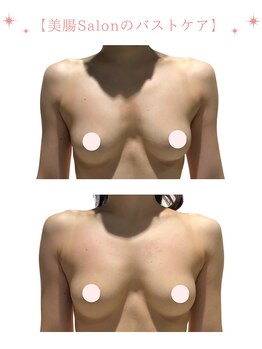 カルム(Calme)/20代 ブライダルバストケア