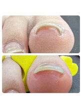 ネイルサロン ミツ(Nailsalon 32)