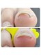 ネイルサロン ミツ(Nailsalon 32)の写真/☆巻き爪ケアがお得に！一度で痛み解消◎変形・トラブル爪も諦めないで♪