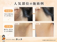 タッチ