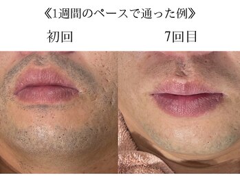 サロン ド アピール(salon de APPEAL)/